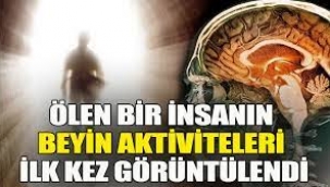 Bilim insanları, ölen bir insanın beyin aktivitelerini ilk kez görüntüledi